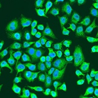 IGF2BP3 Rabbit Polyclonal Antibody