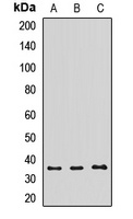 TOM34 Rabbit Polyclonal Antibody