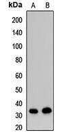 EXOSC8 Rabbit Polyclonal Antibody