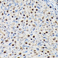 GTPBP4 Rabbit Polyclonal Antibody
