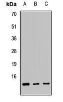 ATPIF1 Rabbit Polyclonal Antibody