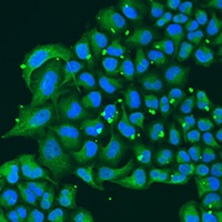 ATPIF1 Rabbit Polyclonal Antibody