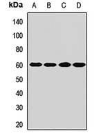 SLC22A12 Rabbit Polyclonal Antibody