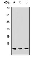 DNAJC19 Rabbit Polyclonal Antibody