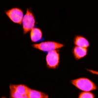 DNAJC19 Rabbit Polyclonal Antibody