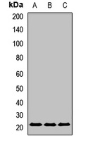 UBE2F Rabbit Polyclonal Antibody