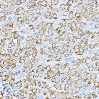 UBE2F Rabbit Polyclonal Antibody