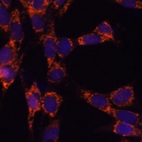UBE2F Rabbit Polyclonal Antibody