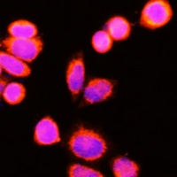 GSTK1 Rabbit Polyclonal Antibody