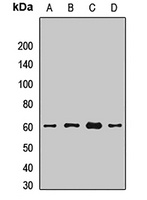 BACE1 Rabbit Polyclonal Antibody