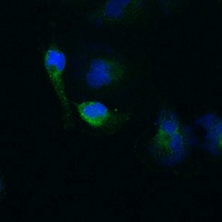BACE1 Rabbit Polyclonal Antibody