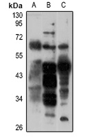 CD63 Rabbit Polyclonal Antibody