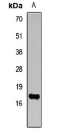 Histone H3 (TriMethyl-K14) Rabbit Polyclonal Antibody