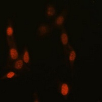 Histone H3 (TriMethyl-K14) Rabbit Polyclonal Antibody