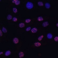 Histone H3 (TriMethyl-K14) Rabbit Polyclonal Antibody