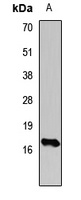 Histone H3 (TriMethyl-K14) Rabbit Polyclonal Antibody