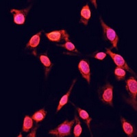 Histone H3 (TriMethyl-K14) Rabbit Polyclonal Antibody