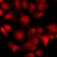 EBP1 Rabbit Polyclonal Antibody