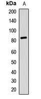 RSK2 Rabbit Polyclonal Antibody