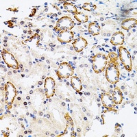 RSK2 Rabbit Polyclonal Antibody