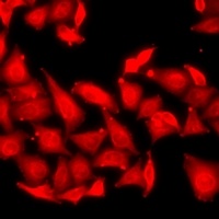 RSK2 Rabbit Polyclonal Antibody