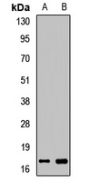Myoglobin Rabbit Polyclonal Antibody
