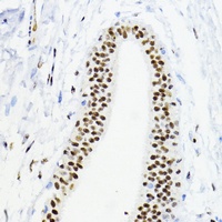 AREB6 Rabbit Polyclonal Antibody