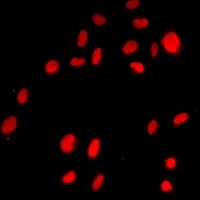 AREB6 Rabbit Polyclonal Antibody