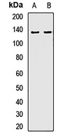 ECE1 Rabbit Polyclonal Antibody