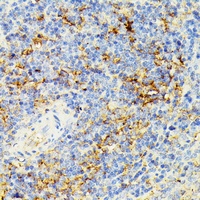 ECE1 Rabbit Polyclonal Antibody