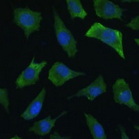 ECE1 Rabbit Polyclonal Antibody