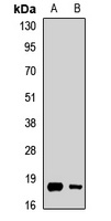 Leptin Rabbit Polyclonal Antibody