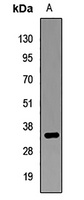 CDX1 Rabbit Polyclonal Antibody