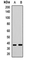 FUT2 Rabbit Polyclonal Antibody