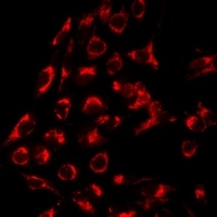 Serpin A6 Rabbit Polyclonal Antibody