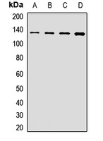 POLR2B Rabbit Polyclonal Antibody