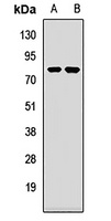 PABPC4 Rabbit Polyclonal Antibody
