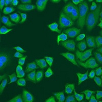 PABPC4 Rabbit Polyclonal Antibody