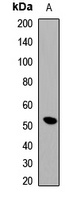 PABPN1 Rabbit Polyclonal Antibody