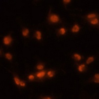 PRPF8 Rabbit Polyclonal Antibody