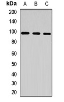 CLCN2 Rabbit Polyclonal Antibody