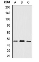 SMYD5 Rabbit Polyclonal Antibody