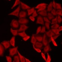 SMYD5 Rabbit Polyclonal Antibody