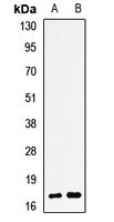 TSSC3 Rabbit Polyclonal Antibody