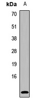 UCN2 Rabbit Polyclonal Antibody
