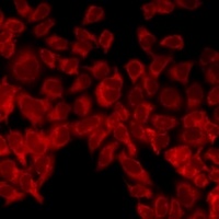 UCN2 Rabbit Polyclonal Antibody