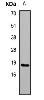 IL-17F Rabbit Polyclonal Antibody