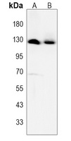 GLI2 Rabbit Polyclonal Antibody