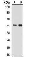 BLMH Rabbit Polyclonal Antibody