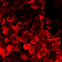 BLMH Rabbit Polyclonal Antibody